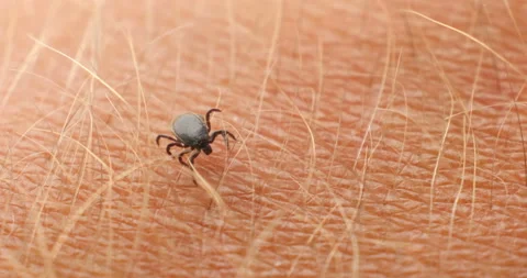 Tick crawling in hairs - 4K macro shot Stock Footage 158289873