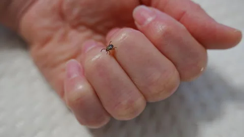Tick crawling on human finger, tick bite and Lyme disease Vidéo 345475258