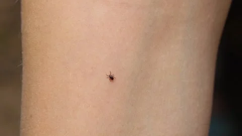 Tick crawling on the human hand close up Stock Footage 143800708