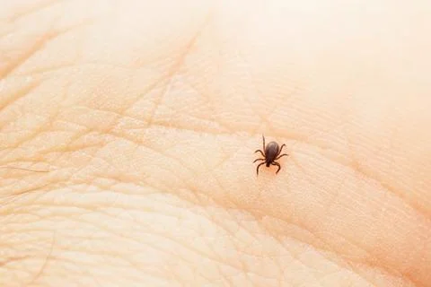Tick is crawling on the human palm Fotos Stock
