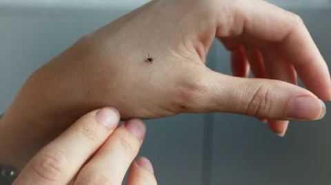 Tick crawling on human Skin Stockbeeldmateriaal 63922625