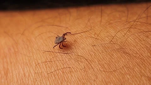 Tick crawling on human skin. macro parasitic insect on hand in natural light Stock Footage 312228926
