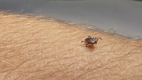 Tick crawling on the skin. Stock Footage 153240045