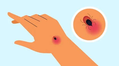 Tick-hand-bite-animation Stock-Footage 276843008
