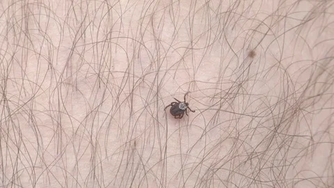 Tick on the human body. Tick crawling close up. 4K Stock Footage 123120367
