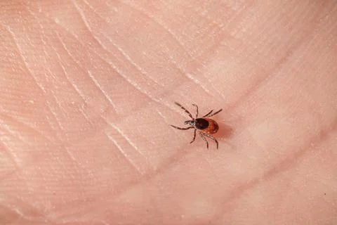 Tick on human skin before bite, risk of Lyme disease, tick borne infections.. Stock Photos
