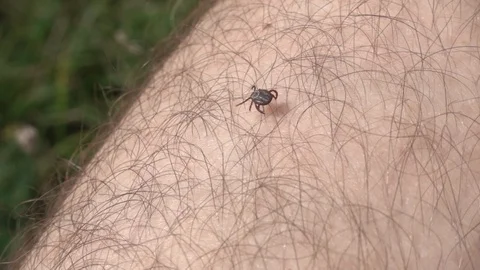 Tick on the human skin slow motion, 240 fps. Tick crawling close up Stock Footage 123119969