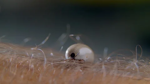 Tick infected with encephalitis or lyme disease is preparing to sting a person Stock Footage 199621458