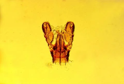 Tick (Ixodes sp.) chelicerae and pedipalps - permanent slide plate Foto stock