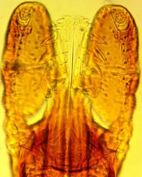 Tick (Ixodes sp.) chelicerae and pedipalps - permanent slide plate Stock Photos