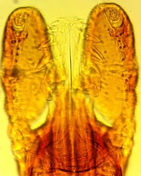 Tick (Ixodes sp.) chelicerae and pedipalps - permanent slide plate Foto stock