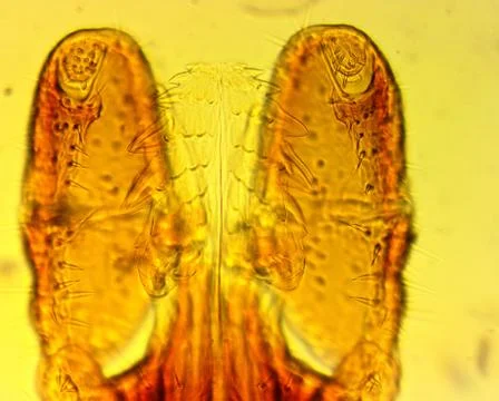 Tick (Ixodes sp.) chelicerae and pedipalps - permanent slide plate Stock Photos