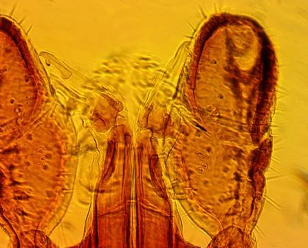 Tick (Ixodes sp.) chelicerae and pedipalps - permanent slide plate Stock-Fotos