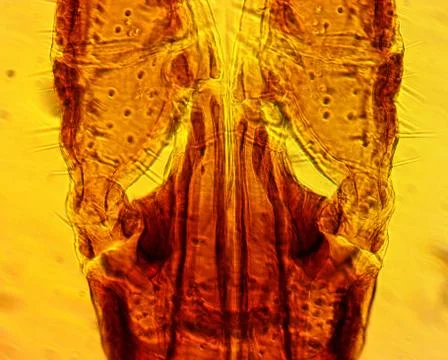 Tick (Ixodes sp.) chelicerae and pedipalps - permanent slide plate Stock Photos
