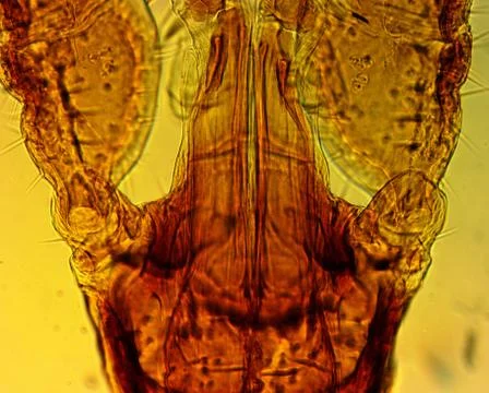 Tick (Ixodes sp.) chelicerae and pedipalps - permanent slide plate Foto stock