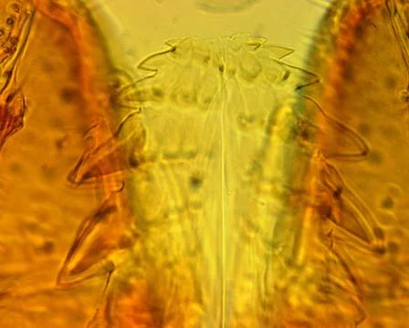 Tick (Ixodes sp.) chelicerae and pedipalps - permanent slide plate Stock Photos