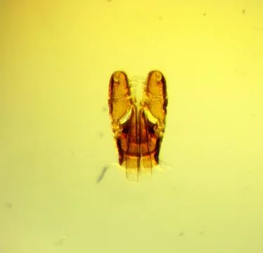 Tick (Ixodes sp.) chelicerae and pedipalps - permanent slide plate Foto stock