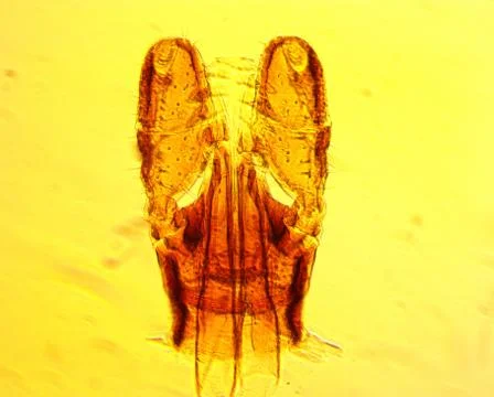 Tick (Ixodes sp.) chelicerae and pedipalps - permanent slide plate Stock Photos
