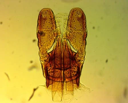Tick (Ixodes sp.) chelicerae and pedipalps - permanent slide plate Foto stock
