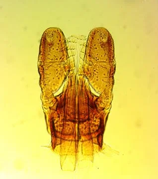 Tick (Ixodes sp.) chelicerae and pedipalps - permanent slide plate Foto stock