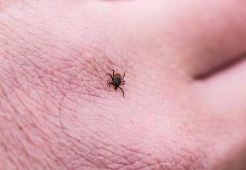 Tick on a man's hand. Stock Photos