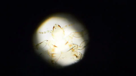 Tick in Microscope Stock Footage 32722192
