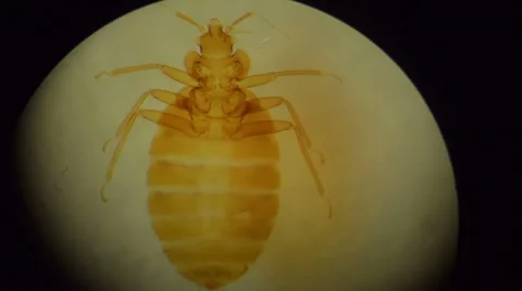 Tick in Microscope Stock Footage 32722193