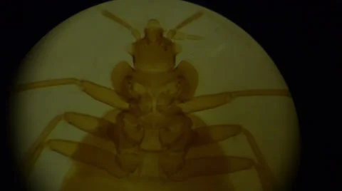 Tick in Microscope Stock Footage 32722196
