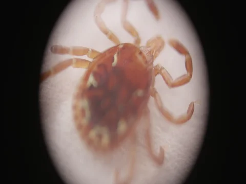 Tick Microscope 動画素材 77553813