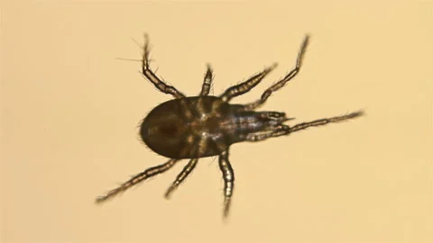 A tick of the order Mesostigmata under a microscope, class Arachnida, superorder Stock Footage 116615448