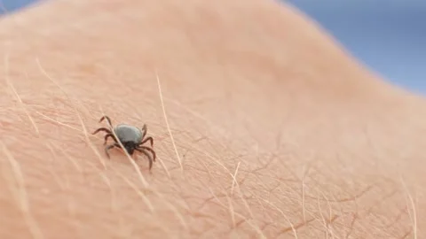 Tick prospecting on human skin Stock Footage 157281679