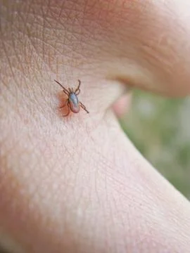 Tick on skin Stock Photos