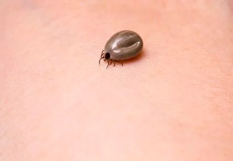 Tick on a skin Stock Photos