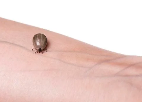 Tick on a skin Stock Photos