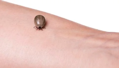 Tick on a skin Stock-Fotos