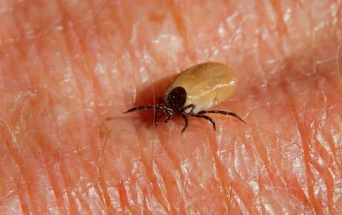 Tick on skin Stock Photos