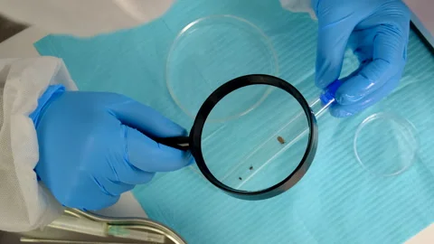 Tick in a test tube in the laboratory. Selective focus. Stock Footage 306638825