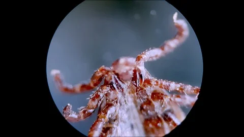 Tick under microsope Stock Footage 122331186