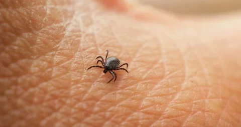 Tick walking on human hand - 4K Stock Footage 158290557