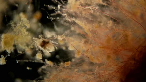 Tick(mite) living in water under a microscope, the superfamily Halacaroidea, the Video stock 128382698