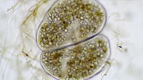 Timelapse of Ciliated Protozoa Binary Fission, Brightfield  Vibrant Microscopy Stock Footage 315418951