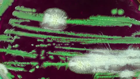 Timelapse of growth of microflora samples in a petri dish in a soil researc.. Stock Footage 227032937