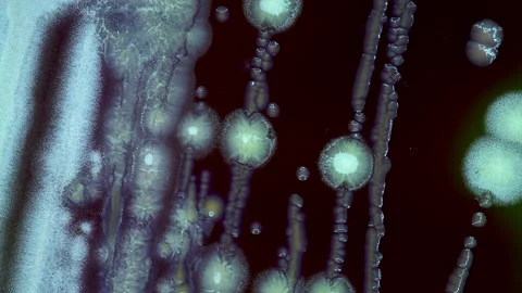 Timelapse of growth of pathogenic bacteria in a Petri dish by infectious di.. Stock Footage 226946246