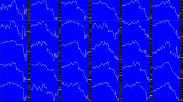 Timelapse screen. Fast time. Market technical analysis. Trading range Stock Footage 85881886