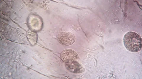 Timelapse video of microscopic animals in an empty mayfly nymph skin Stock Footage 58820304