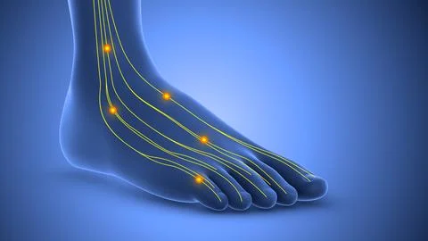 Tingling nerve in the foot Stockillustratie