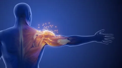Tingling or Sharp Pain in Shoulder Area Stock Footage 289175999