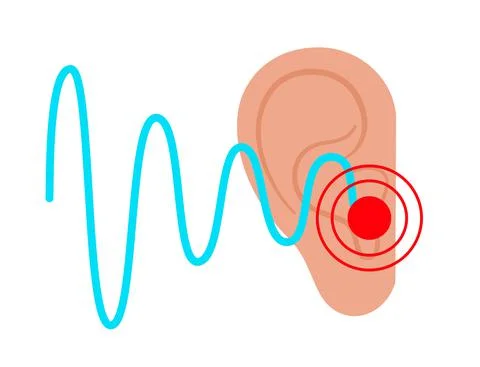 Tinnitus disease concept イラスト素材