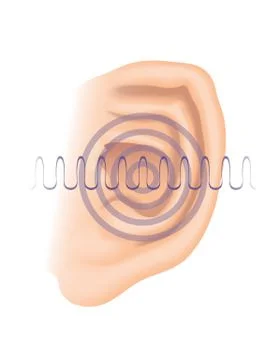 Tinnitus Stock Illustration