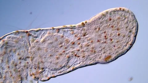 Tiny Aeolosoma Worms Observed Under DIC Microscope Vidéo 317925979